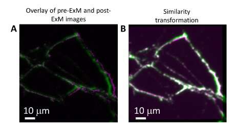 Brighter fluorescent markers allow for finer imaging